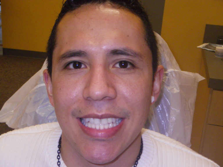 Dental Implants C.E. Solano, D.M.D. Oral & Maxillofacial Surgery