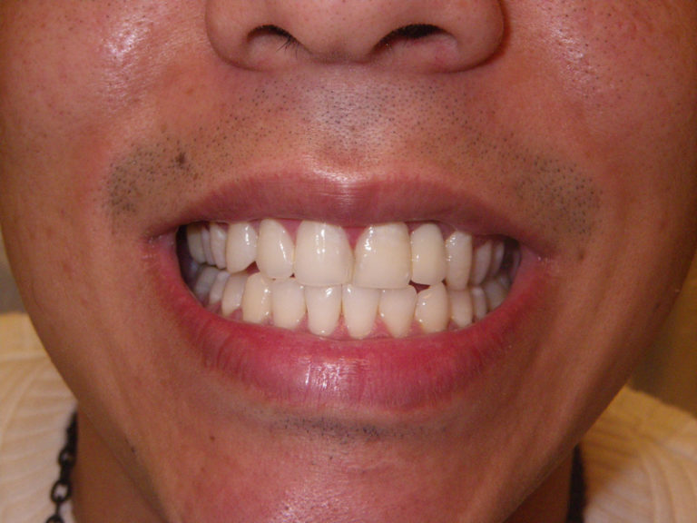 Dental Implants C.E. Solano, D.M.D. Oral & Maxillofacial Surgery