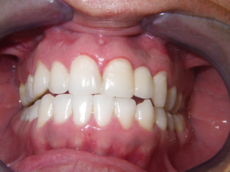 Dental Implants C.E. Solano, D.M.D. Oral & Maxillofacial Surgery